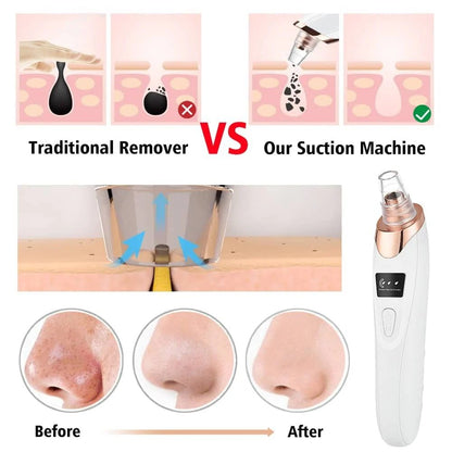 5 Head Electric Blackhead Remover | Vacuum Pore Cleaner | USB Rechargeable Facial Skin Care Device | Deep Cleansing & Exfoliating Tool